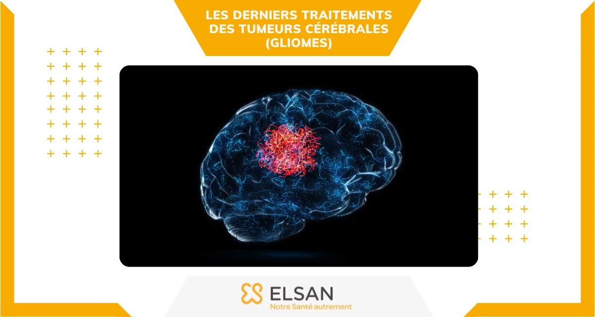 Les derniers traitements des tumeurs cérébrales