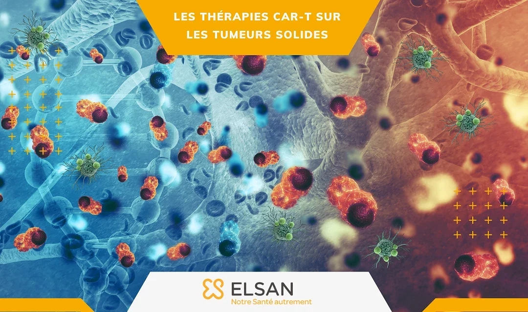 Les thérapies CAR-T sur les tumeurs solides