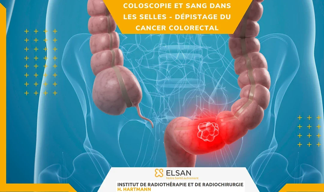 Coloscopie et sang dans les selles – Parcours de dépistage du cancer colorectal