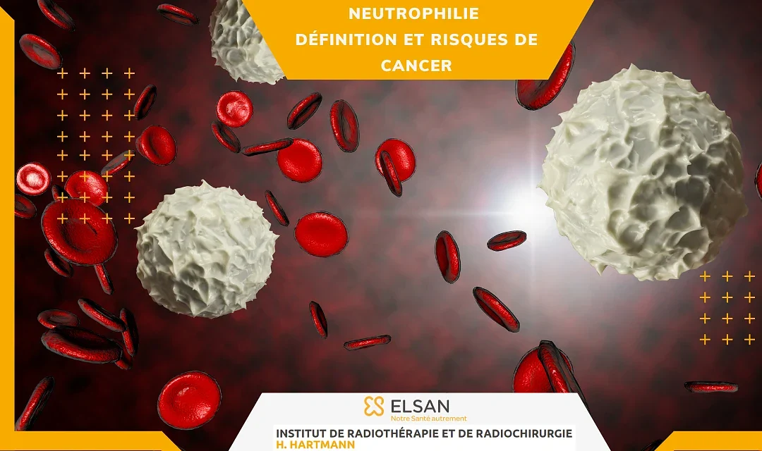 Neutrophilie – définition et risques de cancer