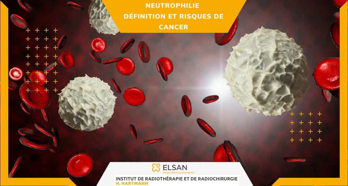 Neutrophilie définition et risques de cancer Neutrophilie définition et risques de cancer